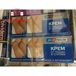 Kem trị nứt gót chân nga kpem